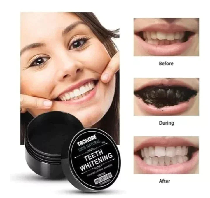 Pasta Blanqueadora Dental