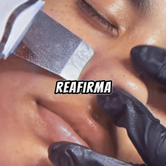 Espátula Facial Ultrasónica Exfoliante