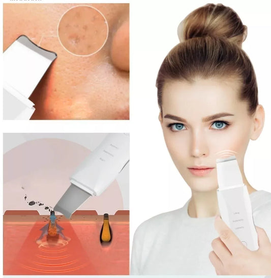 Paleta Ultrasonica Limpiador Facial